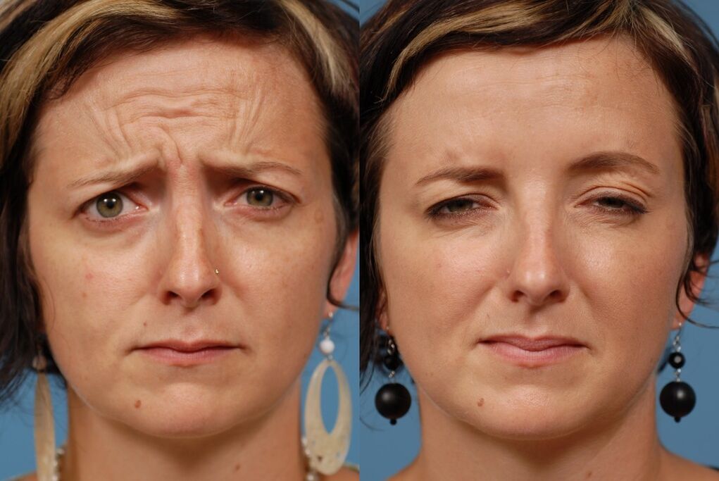 before and after using the massager for rejuvenation ltza photo 2
