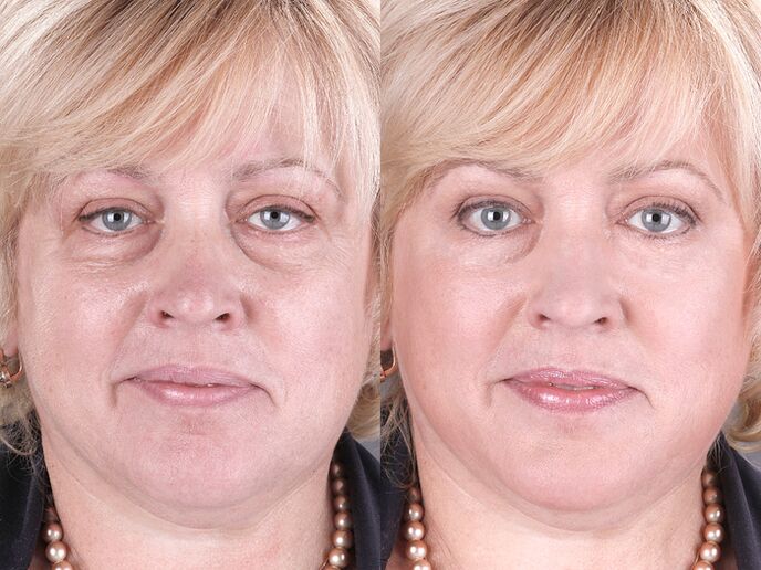 before and after using the massager for rejuvenation ltza photo 3