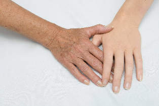 rejuvenation of skin of hands