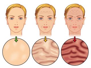stages of aging skin