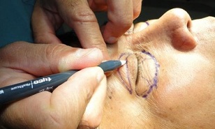 how to rejuvenate the skin around the eyes