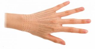 Injection sites for hands during biorevitalization